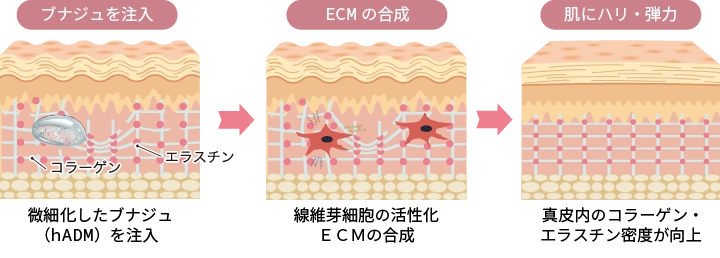 ブナジュのメカニズム