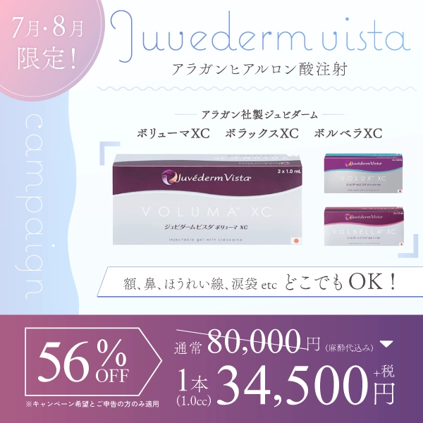 期間限定キャンペーン