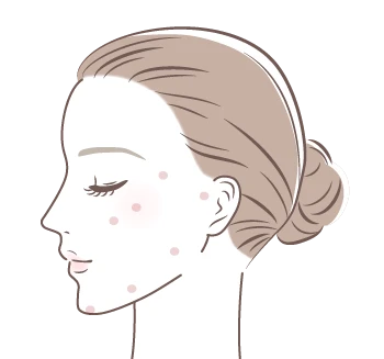 ジャルプロで施術可能な部位